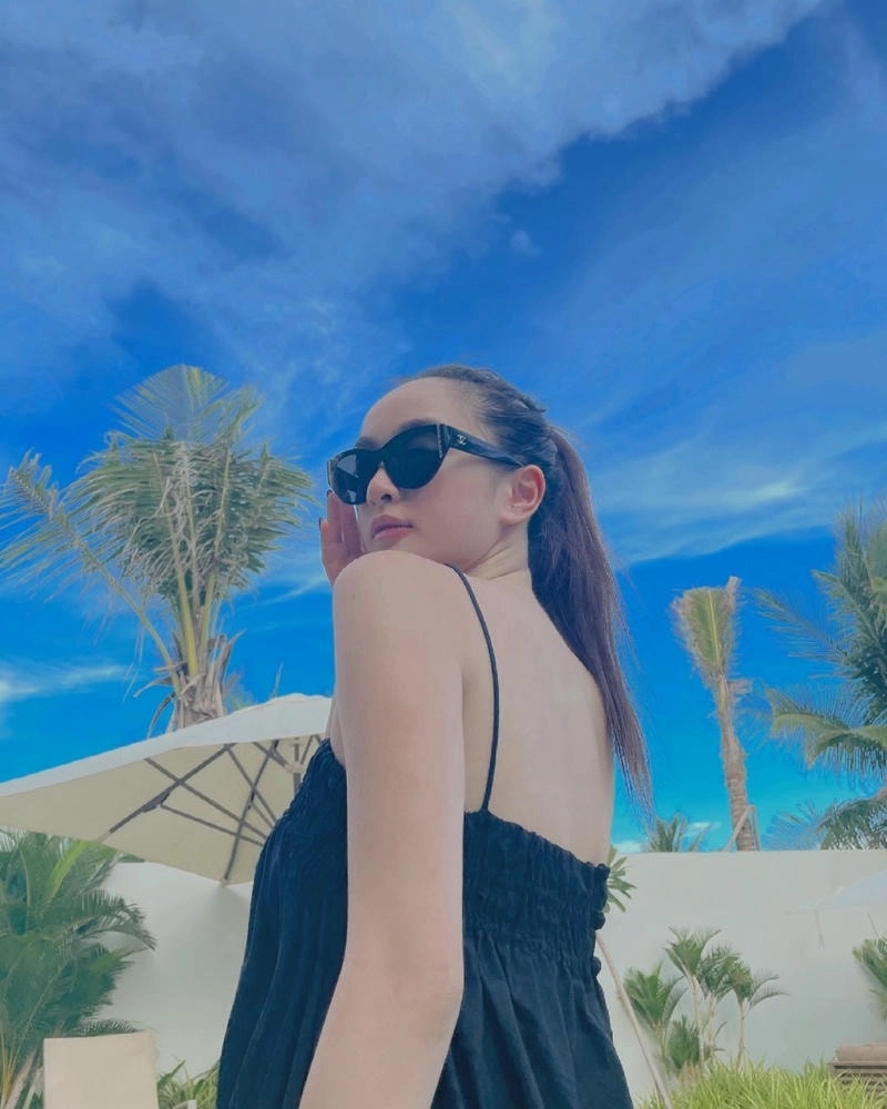 Nghi vấn Kaity Nguyễn phẫu thuật gây tranh cãi